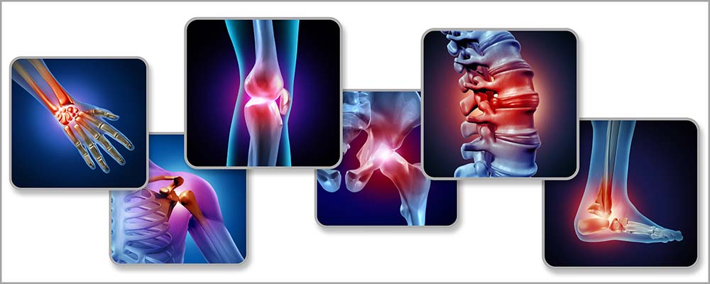 Learning what sets arthritis apart from other injuries